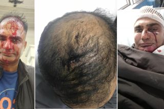 Ο διανομέας Μοχάμεντ Ασλάμ που χτυπήθηκε βίαια από ρατσιστές στα Σεπόλια